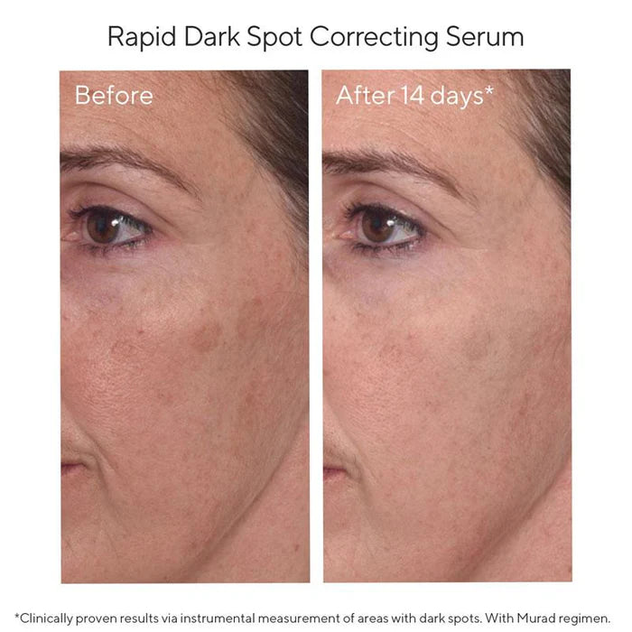 Murad Sale. Murad 15% Off. Murad Rapid Dark Spot Correcting Serum